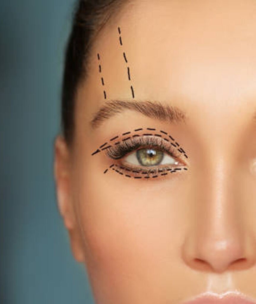 Eyelid Surgery
