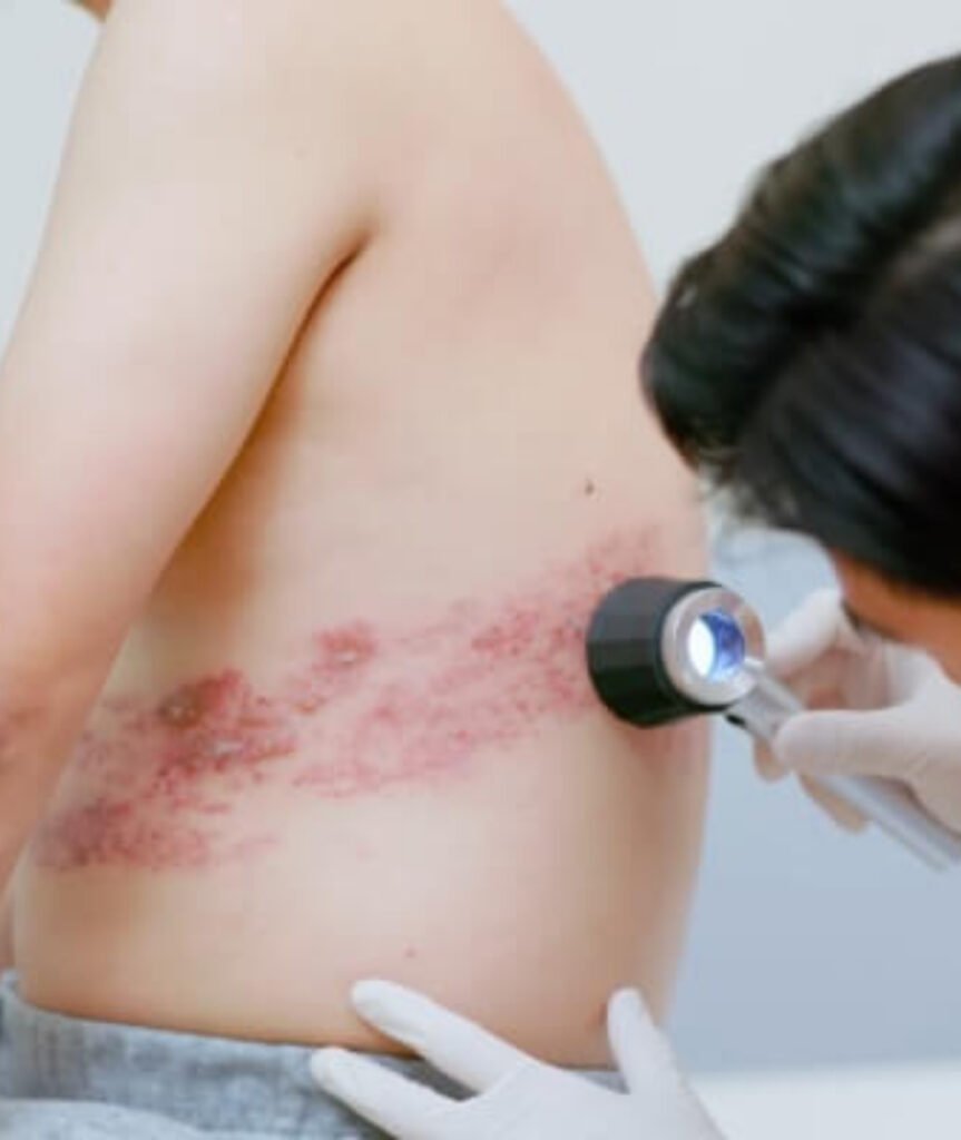 Skin Grafting & Flap Surgeries