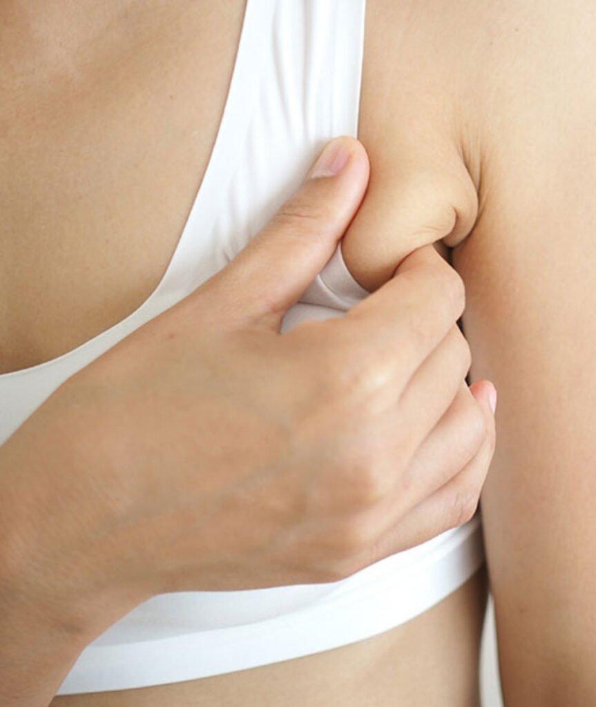 Axillary Breast