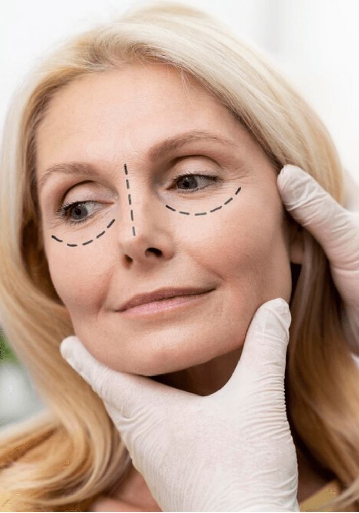 eyelid surgery