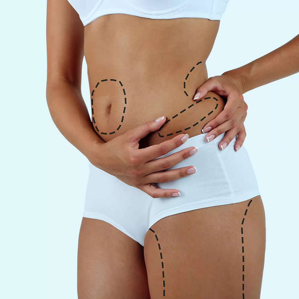 Tummy Tuck Surgery in Indore