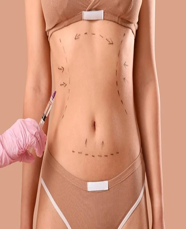 Liposuction Surgery in Udaipur