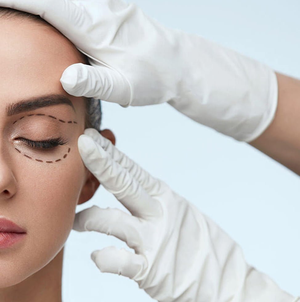Eyelid Surgery in indore